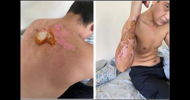 Kazakhstan: New details of torture of participants in the January events