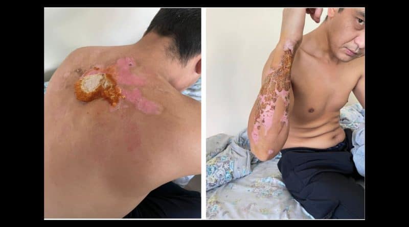 Казахстан: новые подробности пыток над участниками январских событий