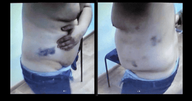 Казахстан: адвокат подвергся пыткам за жалобы на полицейских